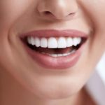Revitalising Smiles The Journey of Full Dental Reconstruction