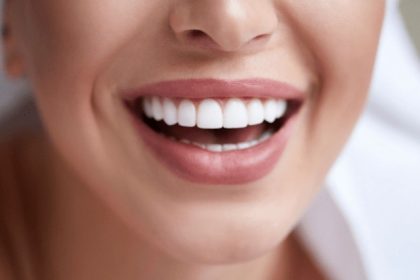 Revitalising Smiles The Journey of Full Dental Reconstruction