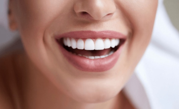 Revitalising Smiles The Journey of Full Dental Reconstruction