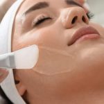 Discover the Benefits of a Lactic Acid Peel for Radiant Skin